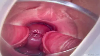 4 Orgasms with Speculum Cervix View - Preview